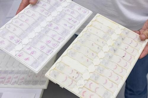 ��������������� ����: ��� �������� ����������������� �� ���������������?