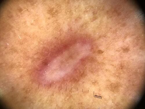 ������� ��������� �� ������ ����� ���� ����