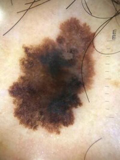 ������ ����� ���� ����