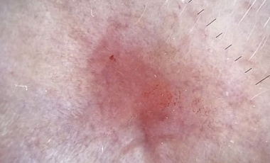 ���������: ������� ��������� � ��������� ������� �������
